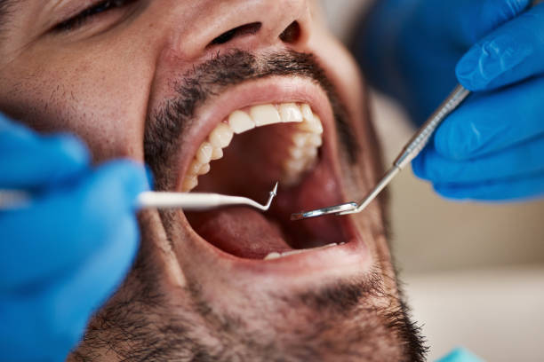 Best Laser Dentistry  in Fountainebleau, FL